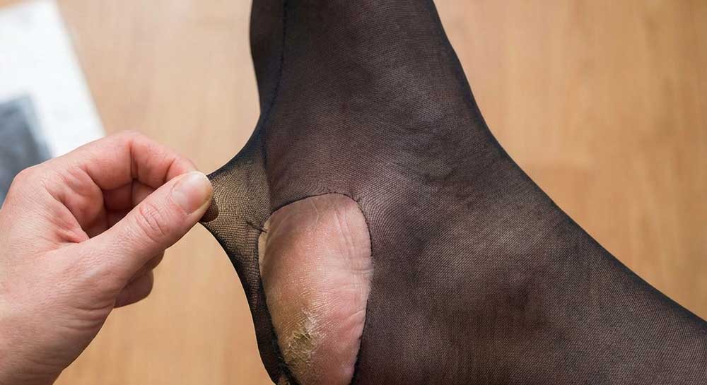 스타킹 올 풀림